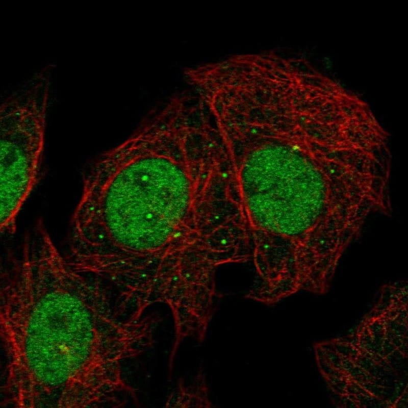 Staining of human cell line SiHa shows localization to nucleoplasm, nucleoli fibrillar center & vesicles.