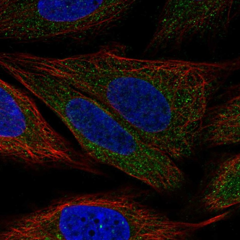 Staining of human cell line SiHa shows localization to cytosol.