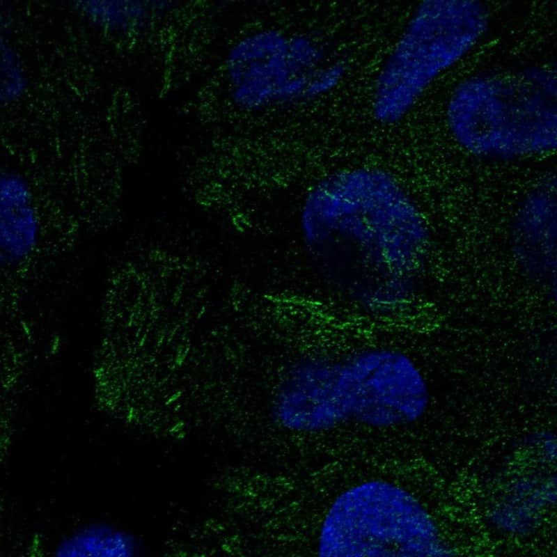 Staining of human cell line RT-4 shows localization to focal adhesion sites.
