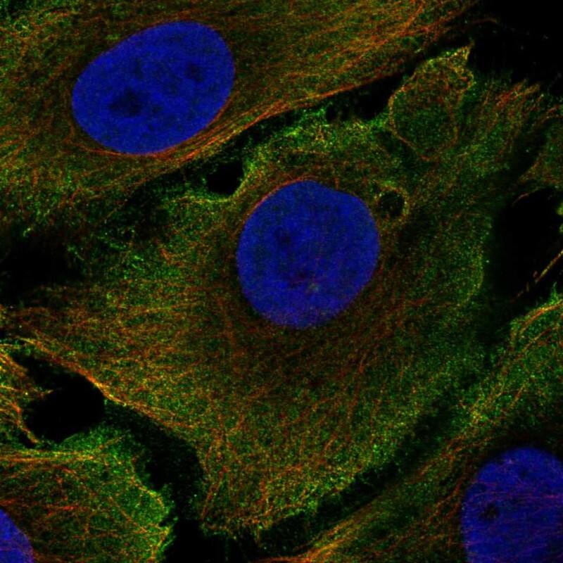 Staining of human cell line GAMG shows localization to plasma membrane.