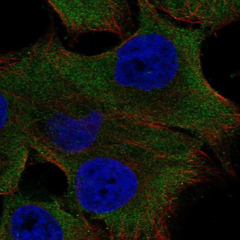 Staining of human cell line SK-MEL-30 shows localization to plasma membrane & cytosol.