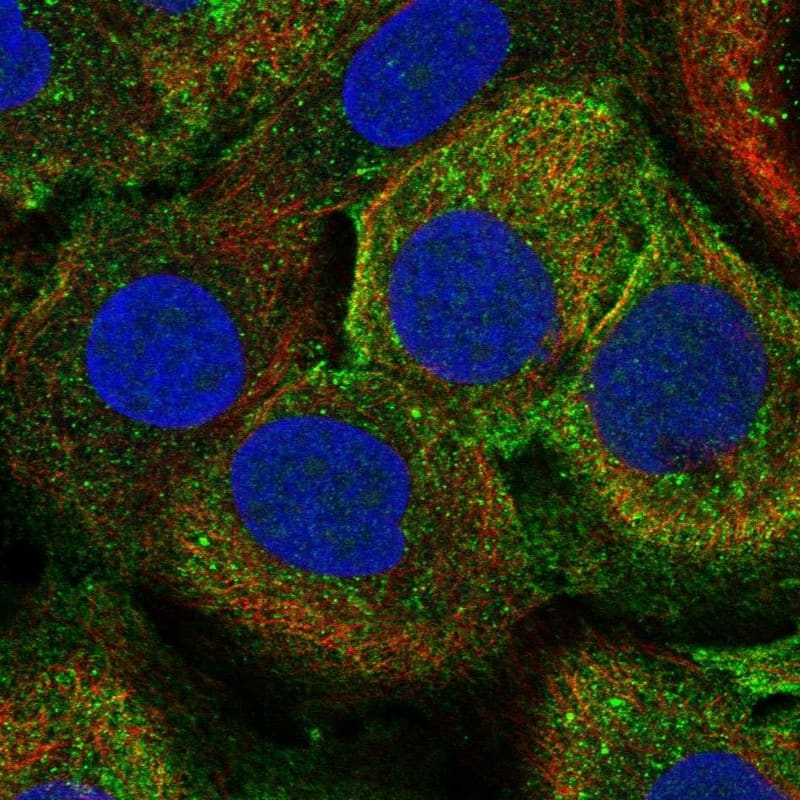 Staining of human cell line HaCaT shows localization to plasma membrane & cytosol.