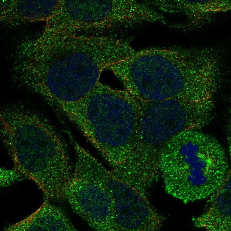 Staining of human cell line OE19 shows localization to cytosol.