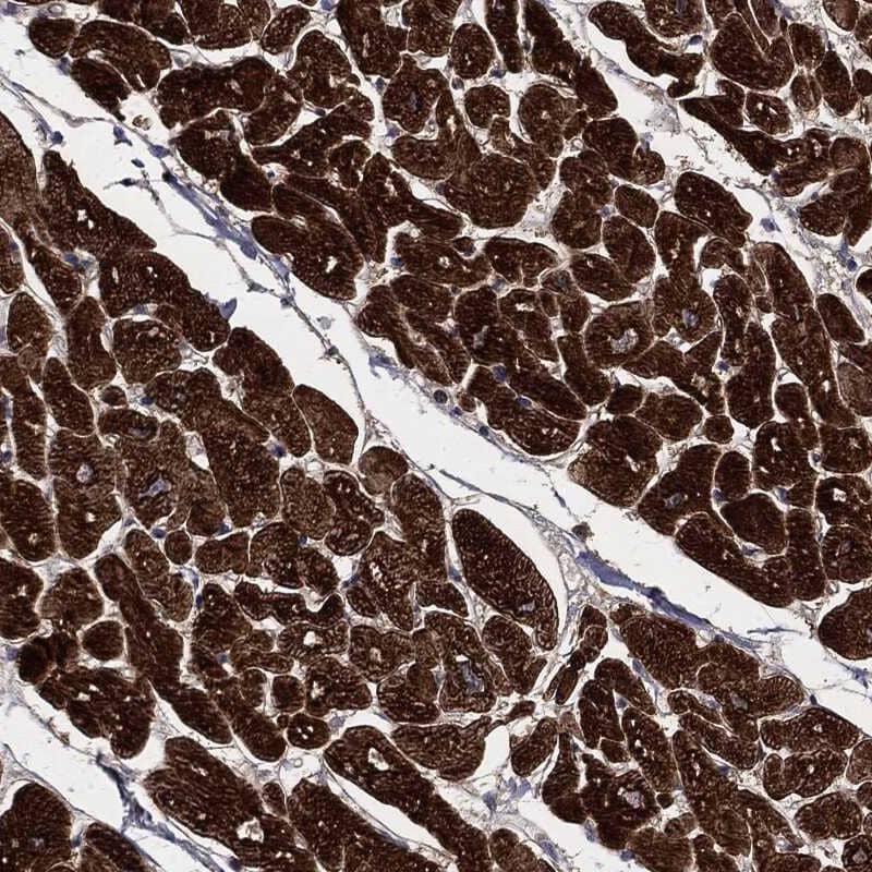 Staining of human heart muscle shows strong cytoplasmic positivity in cardiomyocytes.