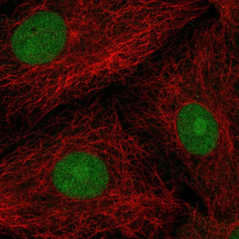 Immunocytochemistry/ Immunofluorescence POP4 Antibody - BSA Free