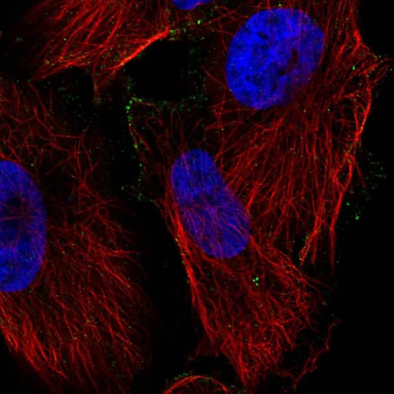 Immunocytochemistry/ Immunofluorescence PPAP2C Antibody