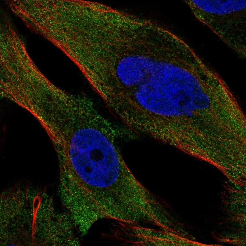 Staining of human cell line GAMG shows localization to cytosol.