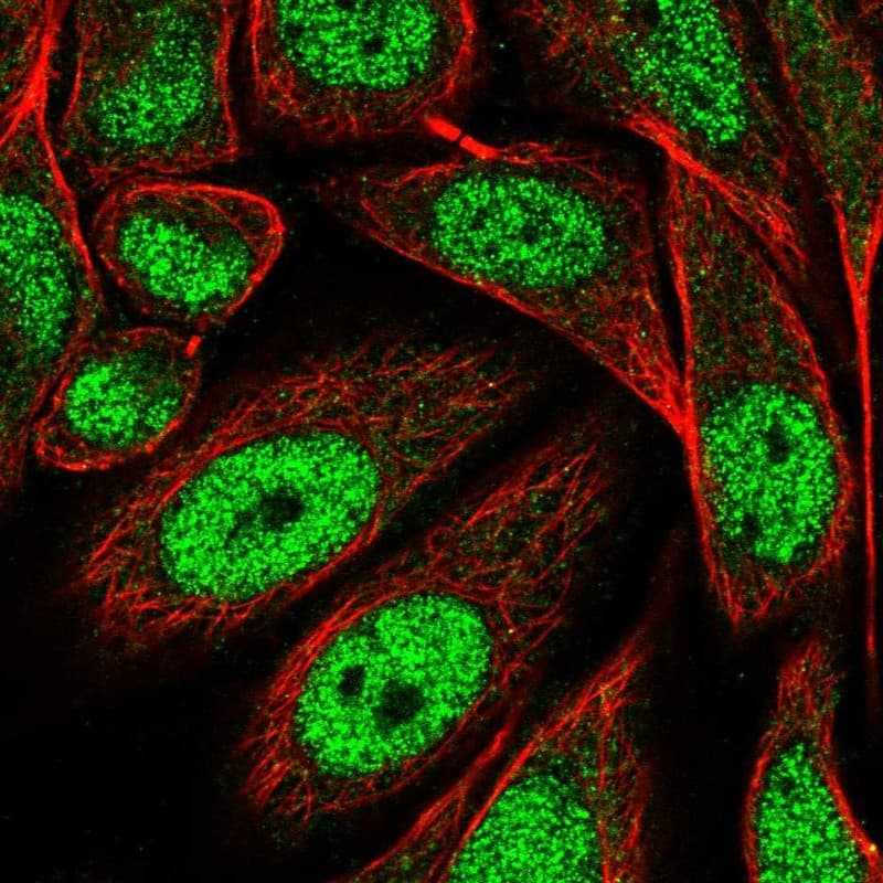 Staining of human cell line SiHa shows localization to nucleoplasm.
