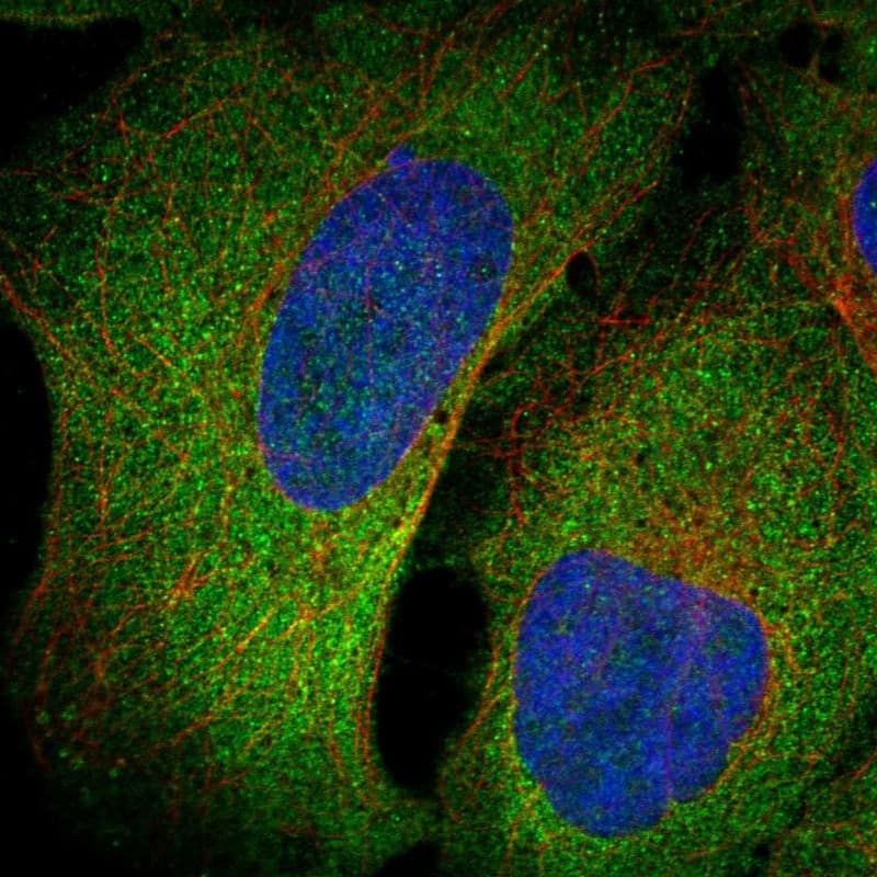 Staining of human cell line U2OS shows localization to endoplasmic reticulum.