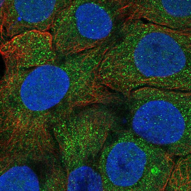 Staining of human cell line HaCaT shows localization to cytosol & vesicles.
