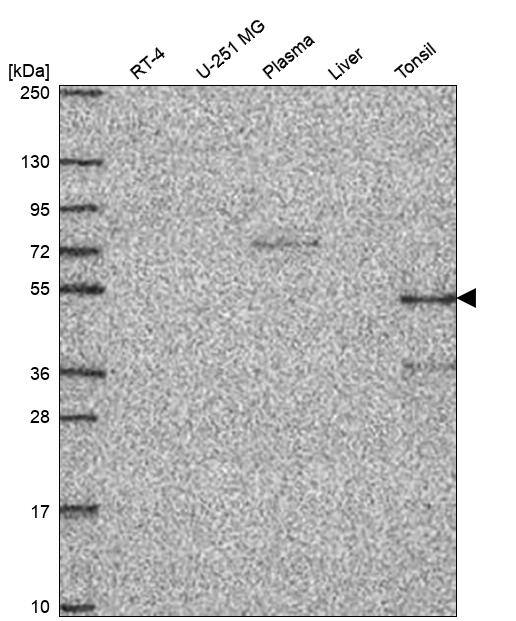 Analysis in human cell line RT-4, human cell line U-251 MG, human plasma, human liver tissue and human tonsil tissue.