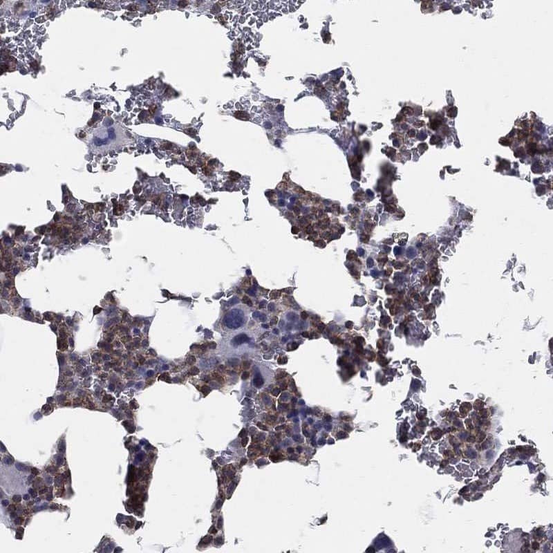 Staining of human bone marrow shows moderate cytoplasmic positivity in hematopoietic cells.
