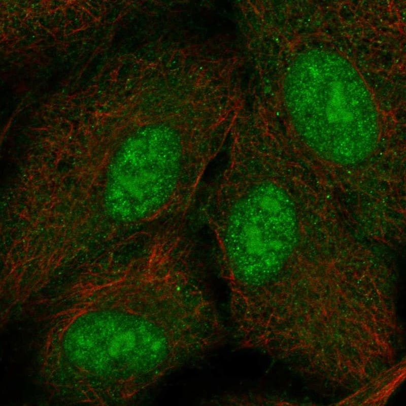 Staining of human cell line A-549 shows localization to nucleoplasm, nucleoli & cytosol.