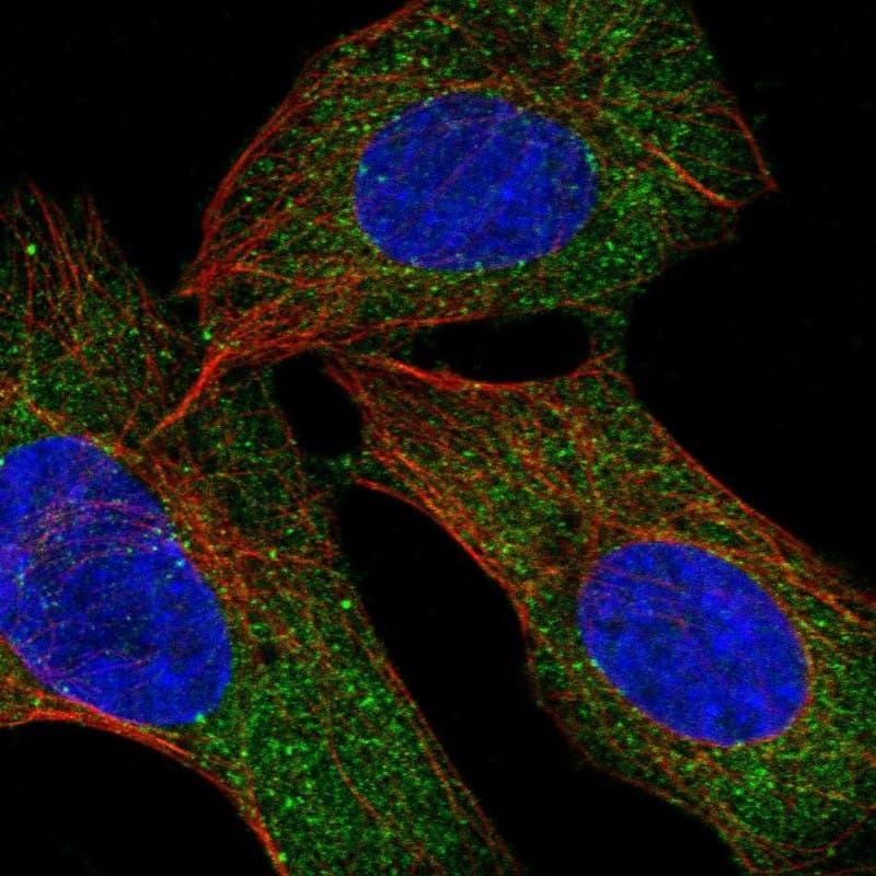 Staining of human cell line SuSa shows localization to cytosol.