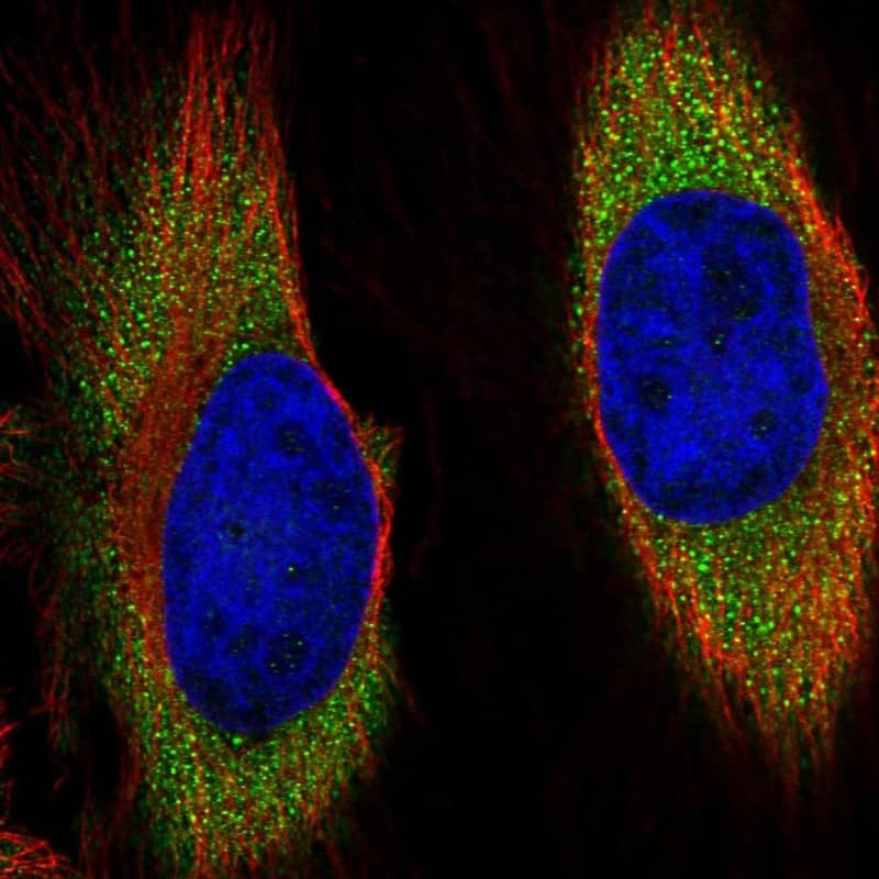 Staining of human cell line HeLa shows localization to cytosol & vesicles.