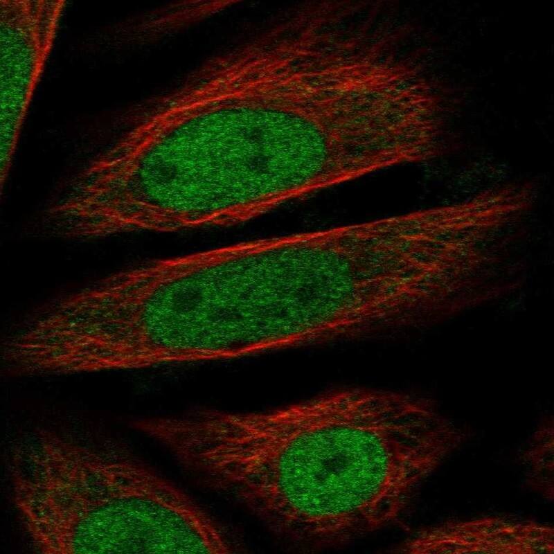 Staining of human cell line SiHa shows localization to nucleoplasm.