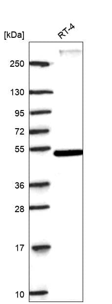 Analysis in human cell line RT-4.