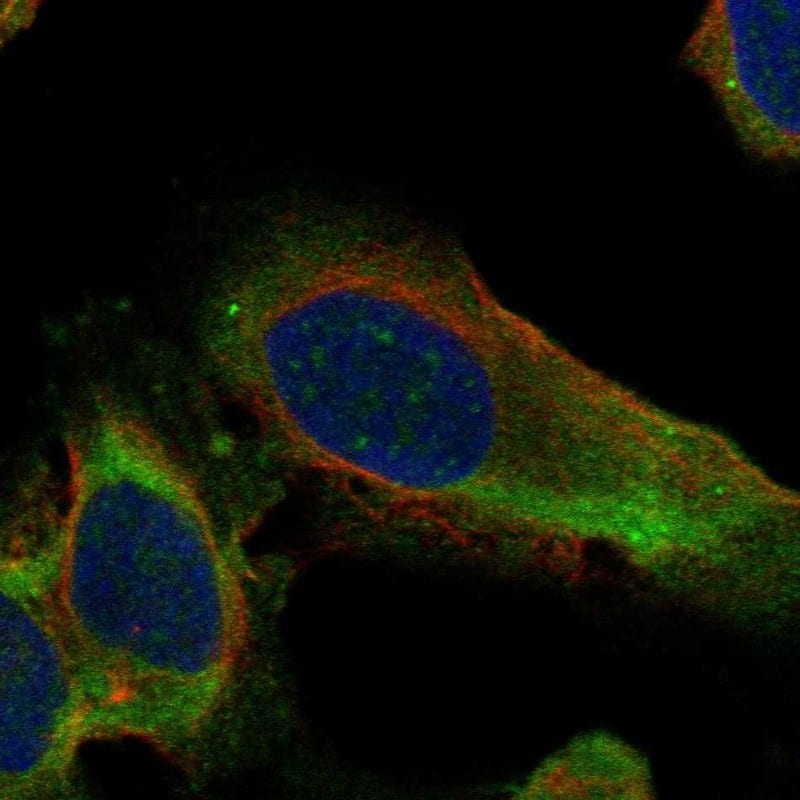 Immunocytochemistry/ Immunofluorescence RPL10A Antibody - BSA Free