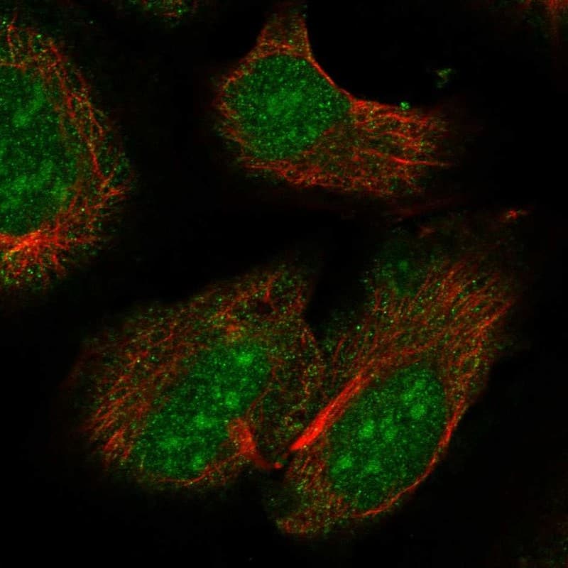 Staining of human cell line U2OS shows localization to nucleoplasm, nucleoli & cytosol.