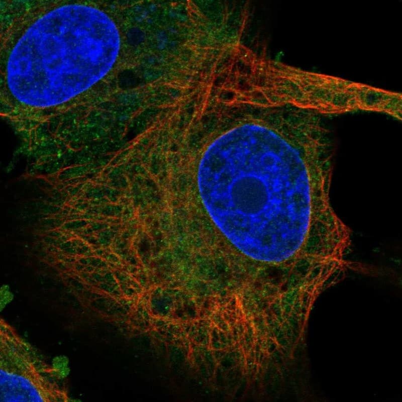 Staining of human cell line GAMG shows localization to endoplasmic reticulum.