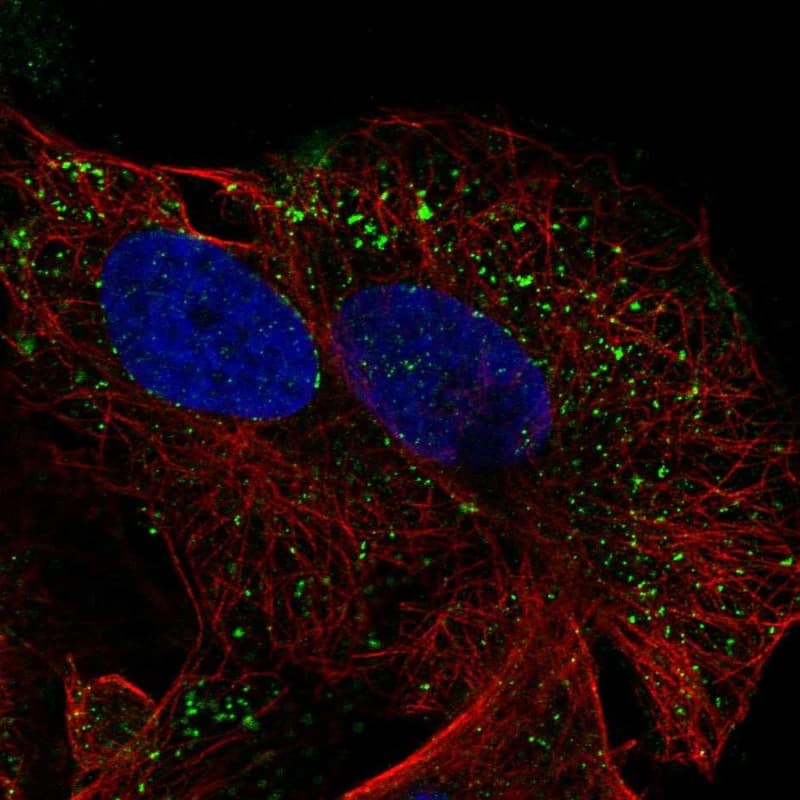 Staining of human cell line U2OS shows localization to vesicles.