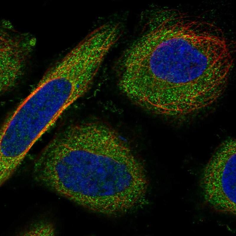 Staining of human cell line SiHa shows localization to cytosol.