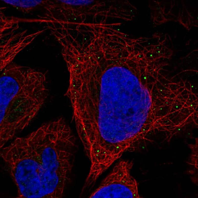 Staining of human cell line U2OS shows localization to vesicles.