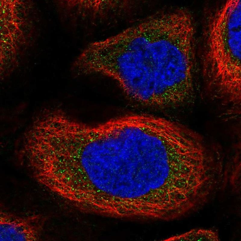 Staining of human cell line A-431 shows localization to cytosol.