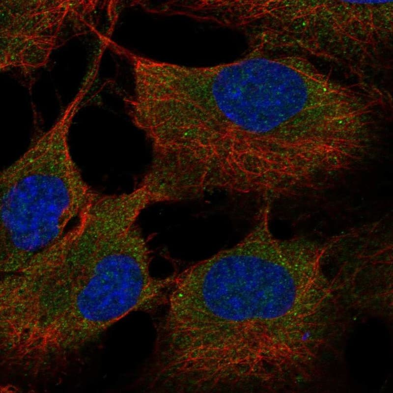 Staining of human cell line hTERT-RPE1 shows localization to cytosol.