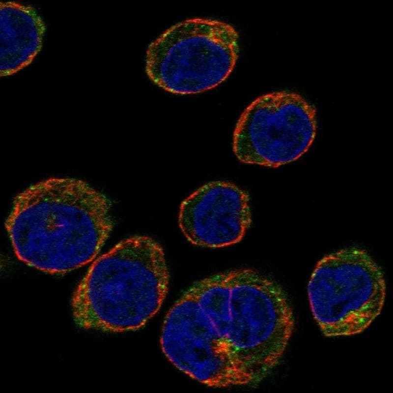 Staining of human cell line HEL shows localization to cytosol & vesicles.