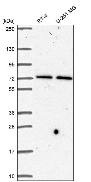 Analysis in human cell line RT-4 and human cell line U-251 MG.