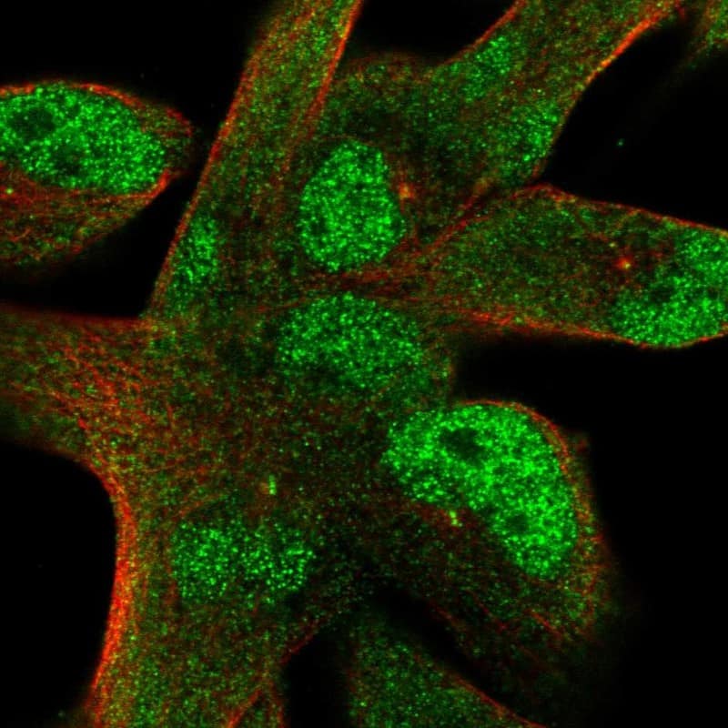 Staining of human cell line Rh30 shows localization to nucleoplasm & centrosome.