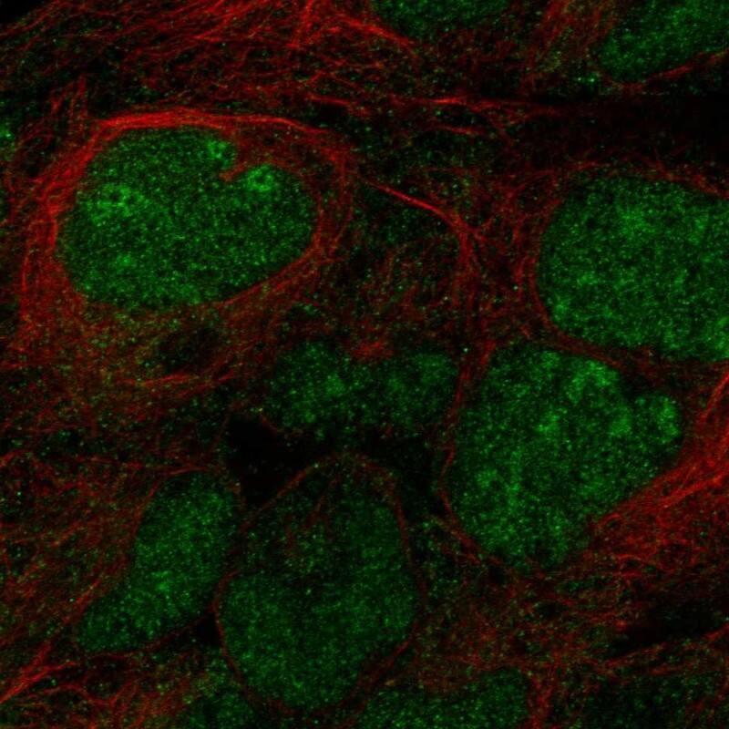 Staining of human cell line HEK293 shows localization to nucleoplasm & nucleoli.