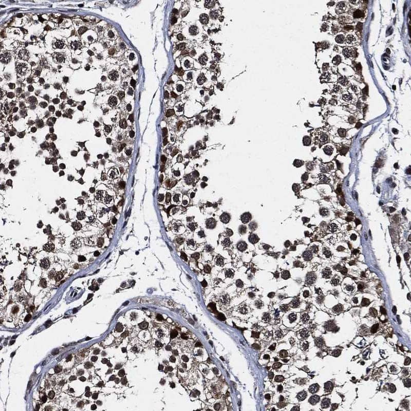 Staining of human testis shows strong cytoplasmic and nuclear positivity in cells in seminiferous ducts.
