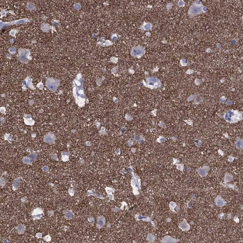 Staining of human cerebral cortex shows strong positivity in neuropil.