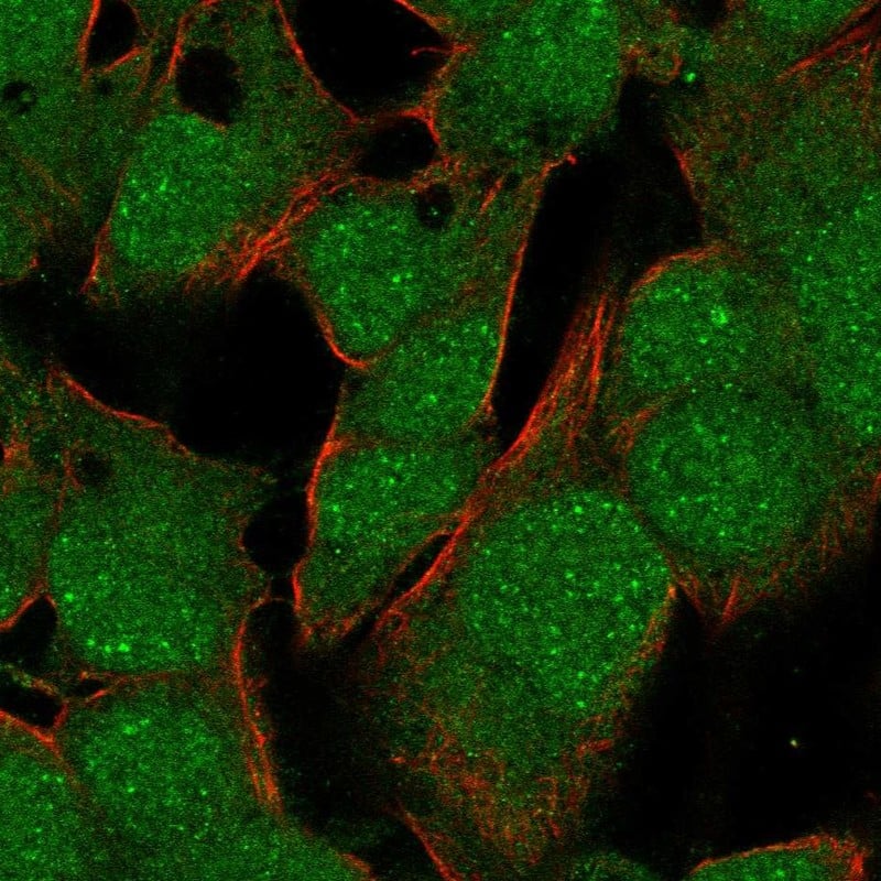 Immunocytochemistry/ Immunofluorescence TBX10 Antibody - BSA Free