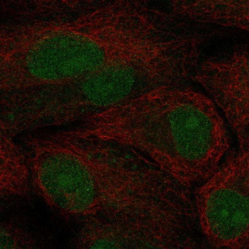 Staining of human cell line A-549 shows localization to nucleoplasm.