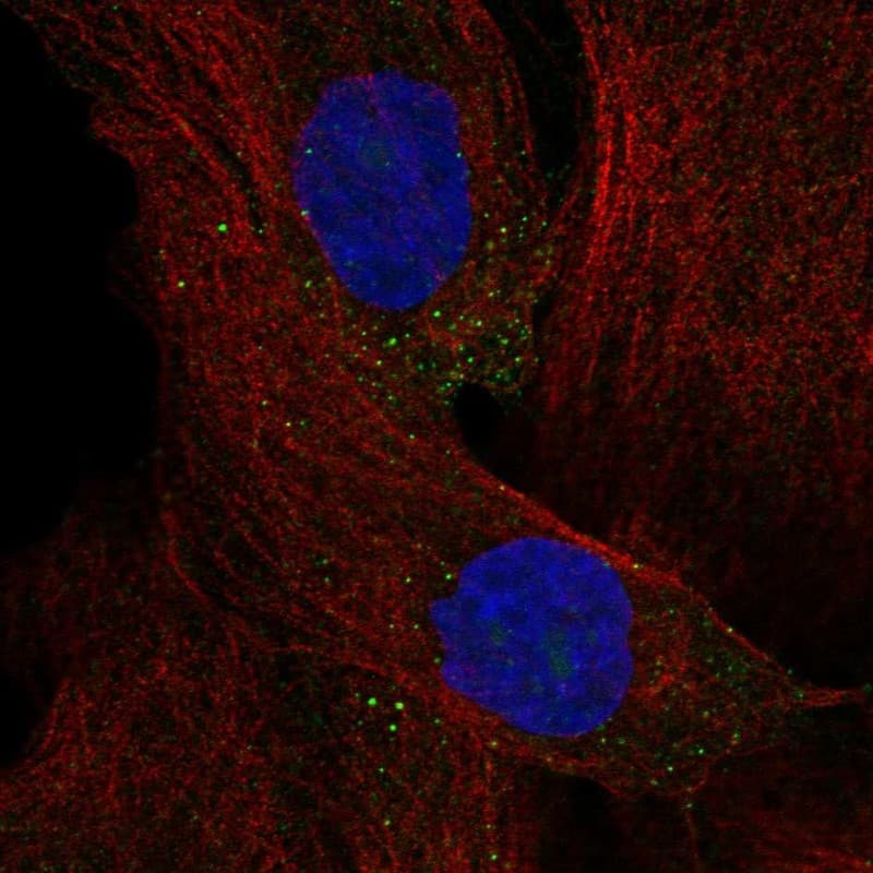 Staining of human cell line EFO-21 shows localization to nucleoli & vesicles.