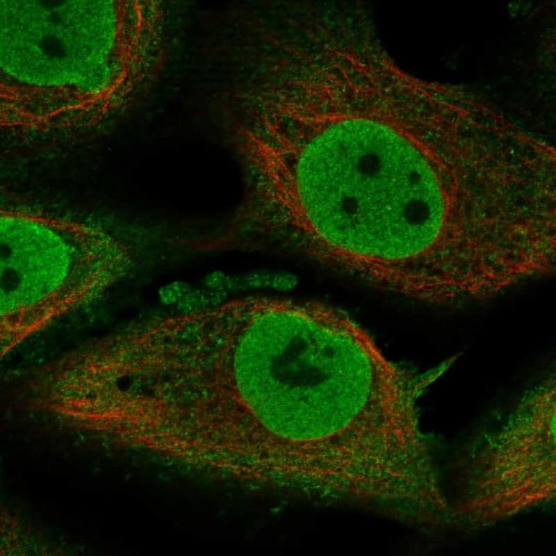 Staining of human cell line GAMG shows localization to nucleoplasm & plasma membrane.