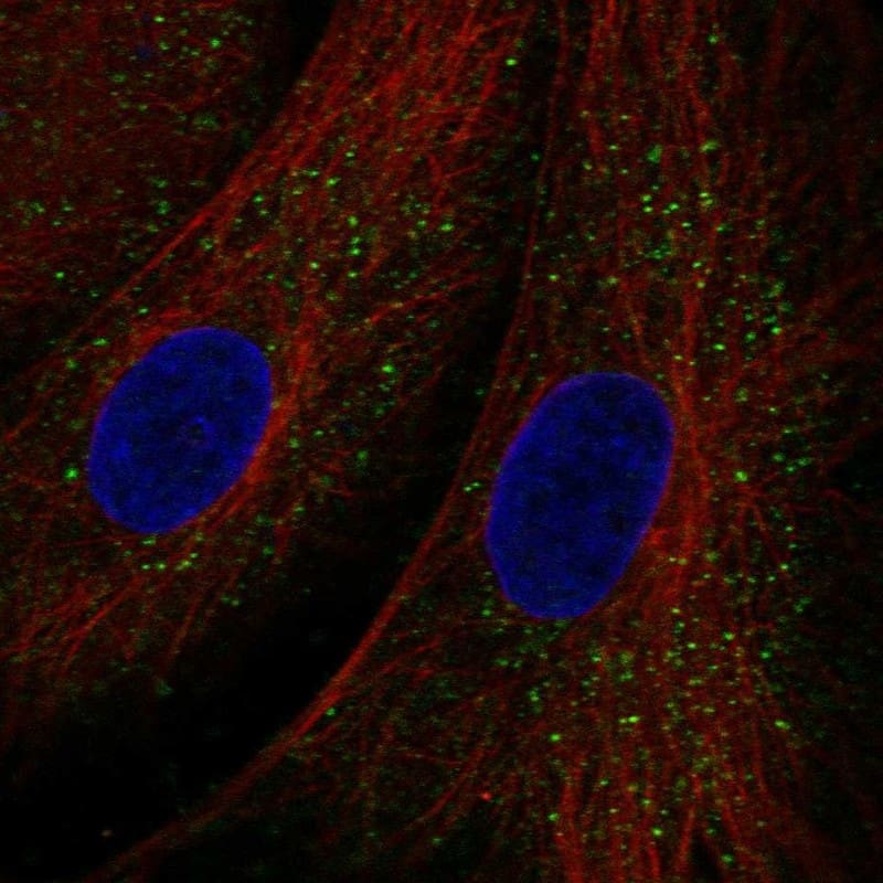 Staining of human cell line BJ [Human fibroblast] shows localization to vesicles.