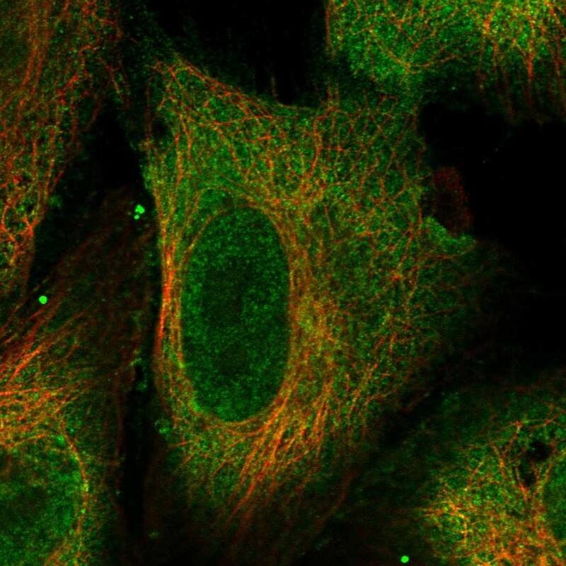 Staining of human cell line GAMG shows localization to nucleoplasm & plasma membrane.