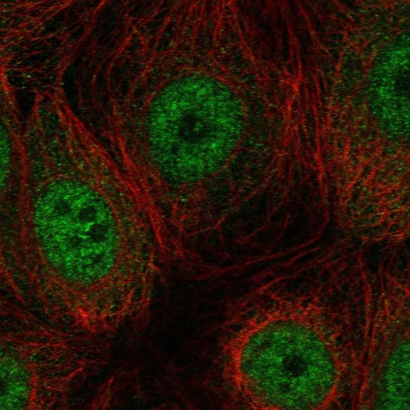Staining of human cell line MCF-7 shows localization to nucleoplasm.