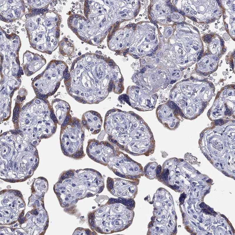 Staining of human placenta shows moderate cytoplasmic positivity in trophoblastic cells.