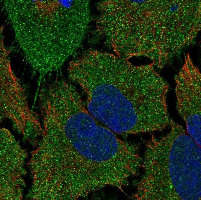 Immunocytochemistry/ Immunofluorescence TMCO5 Antibody - BSA Free