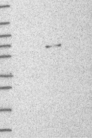 Lane 1: Marker [kDa] 250,130,95,72,55,36,28,17,10Lane 2: RT-4Lane 3: U-251MGLane 4: Human PlasmaLane 5: LiverLane 6: Tonsil