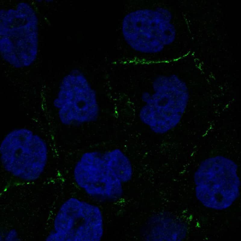 Staining of human cell line EFO-21 shows localization to plasma membrane.