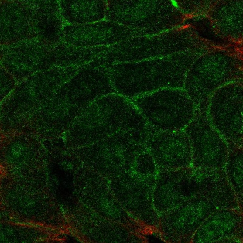 Staining of human cell line OE19 shows localization to nucleoplasm & plasma membrane.