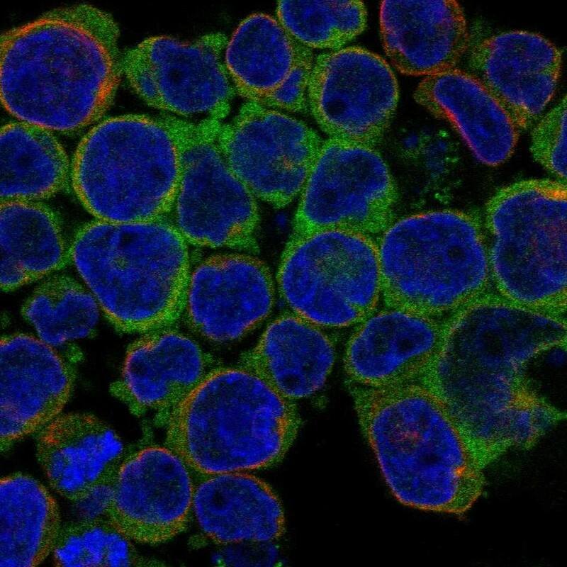 Staining of human cell line REH shows localization to cytosol.