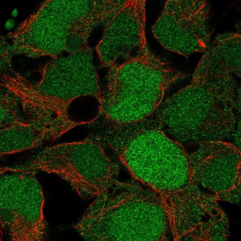 Staining of human cell line HEK293 shows localization to nucleoplasm & cytosol.