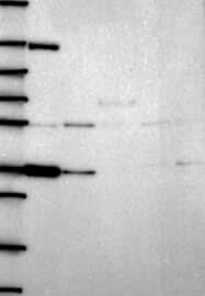 Lane 1: Marker [kDa] 250,130,95,72,55,36,28,17,10Lane 2: RT-4Lane 3: U-251MGLane 4: Human PlasmaLane 5: LiverLane 6: Tonsil